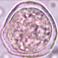 xalapensis